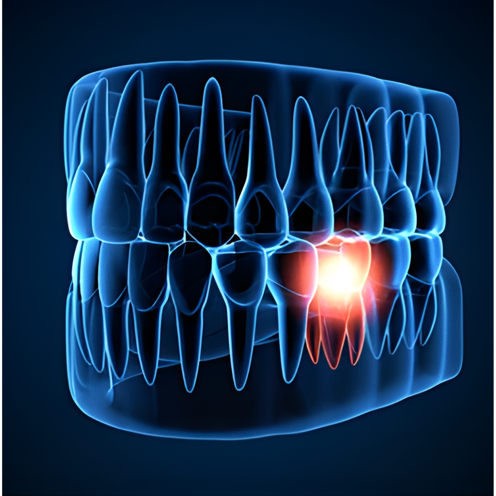 Dental X-ray (OPG)