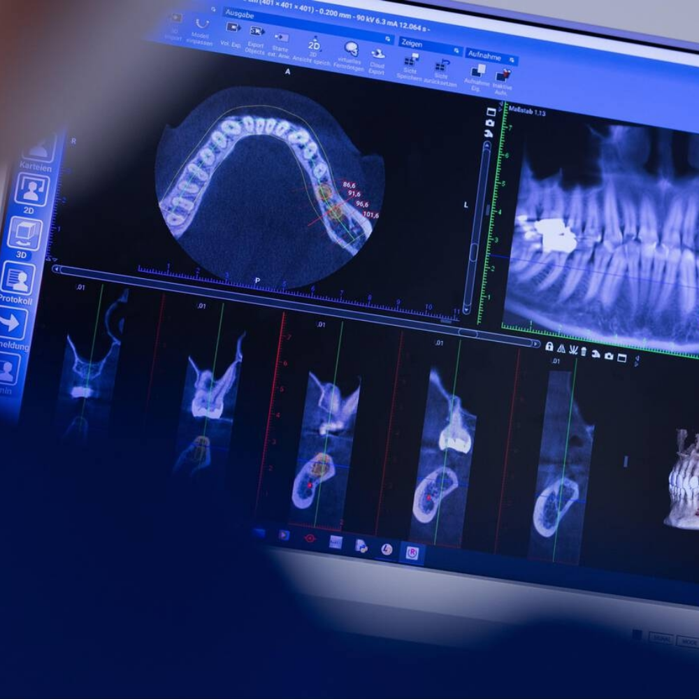 ডিজিটাল এক্স-রে